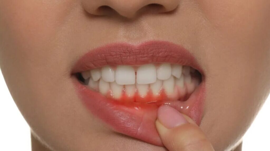 Understanding Gum Health and Why It Matters in Green Bay